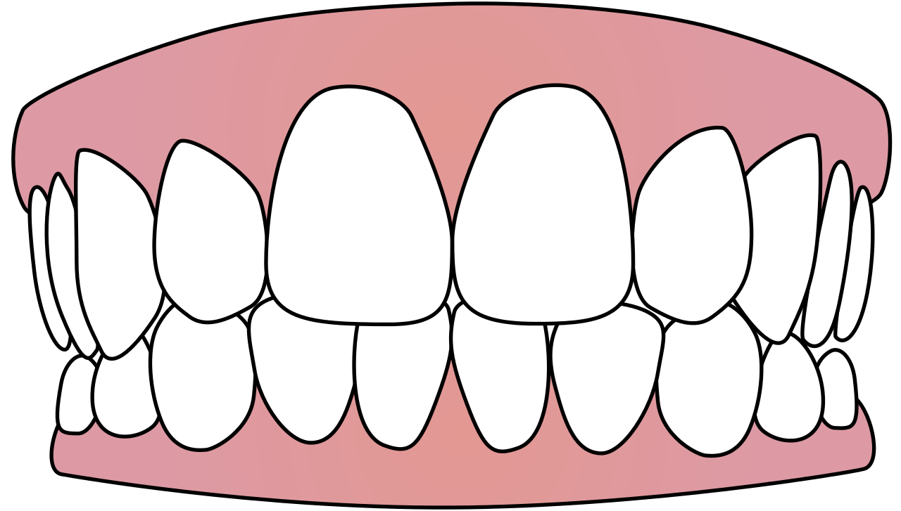 Download PNG image - Clean Tooth PNG File 